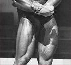 Arnold's legs